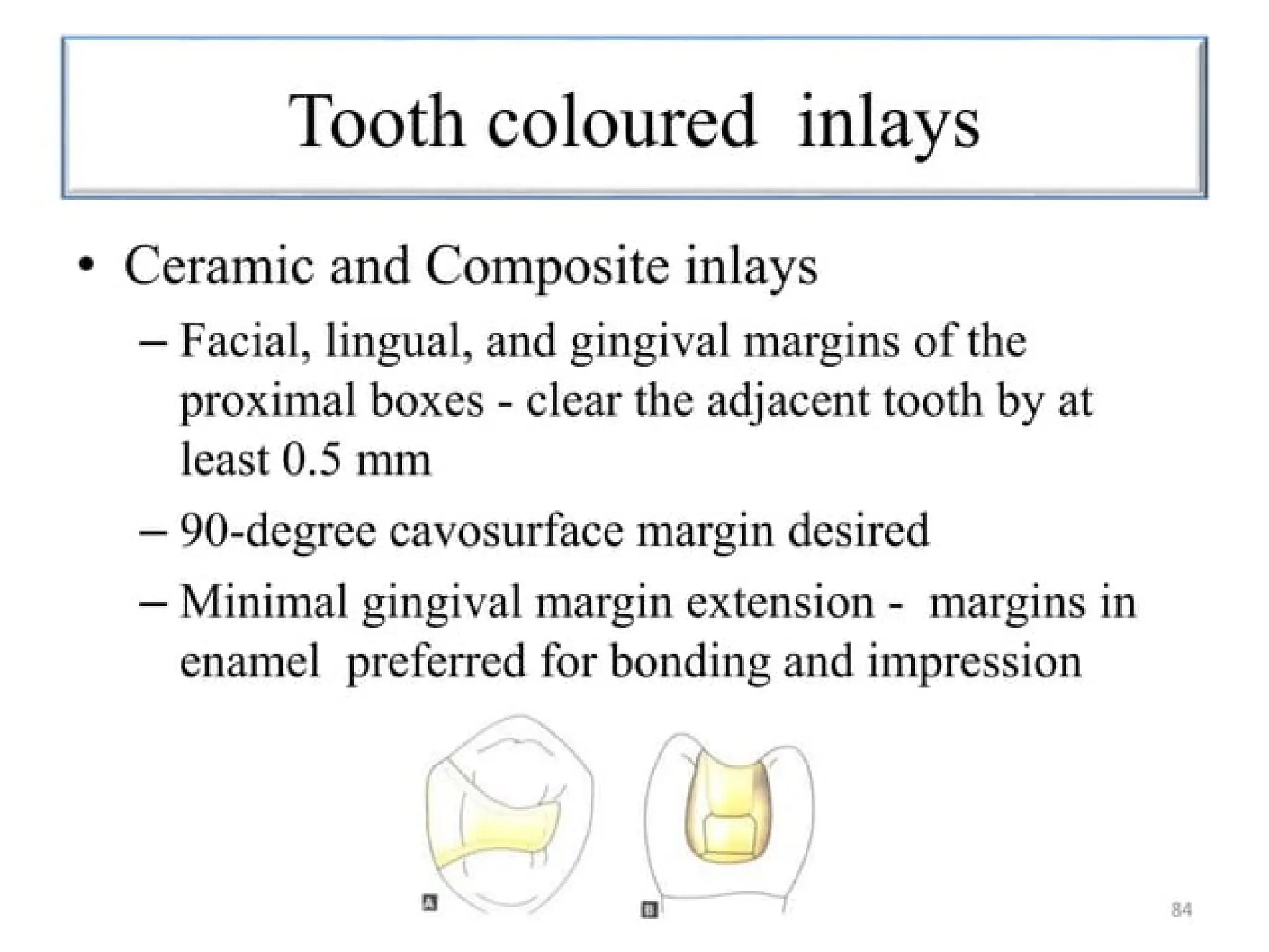 finish lines in fixed partial denture .pptx