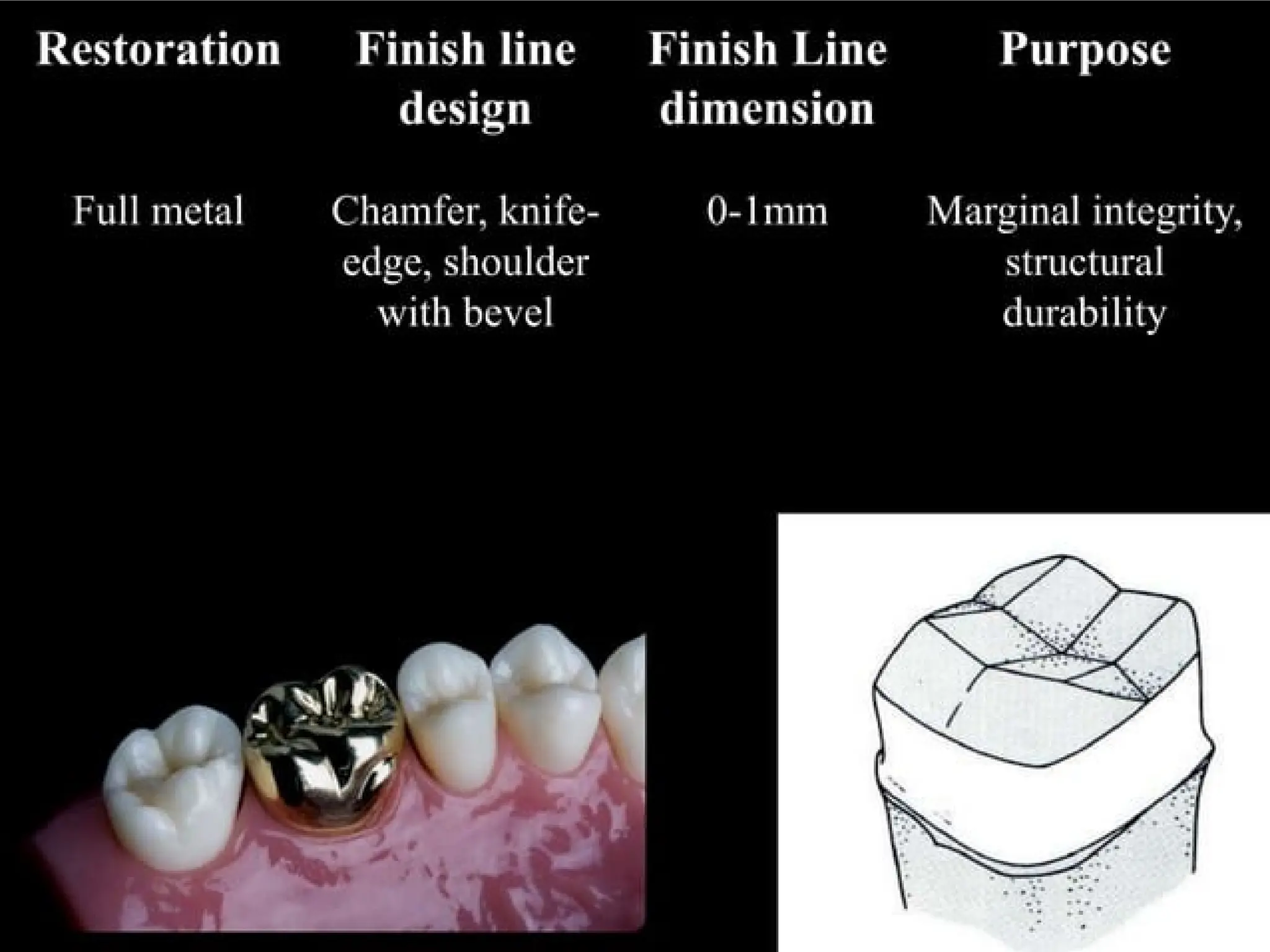 finish lines in fixed partial denture .pptx