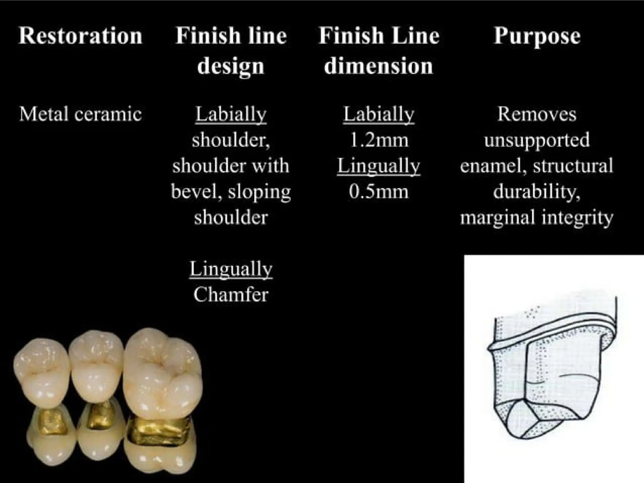finish lines in fixed partial denture .pptx