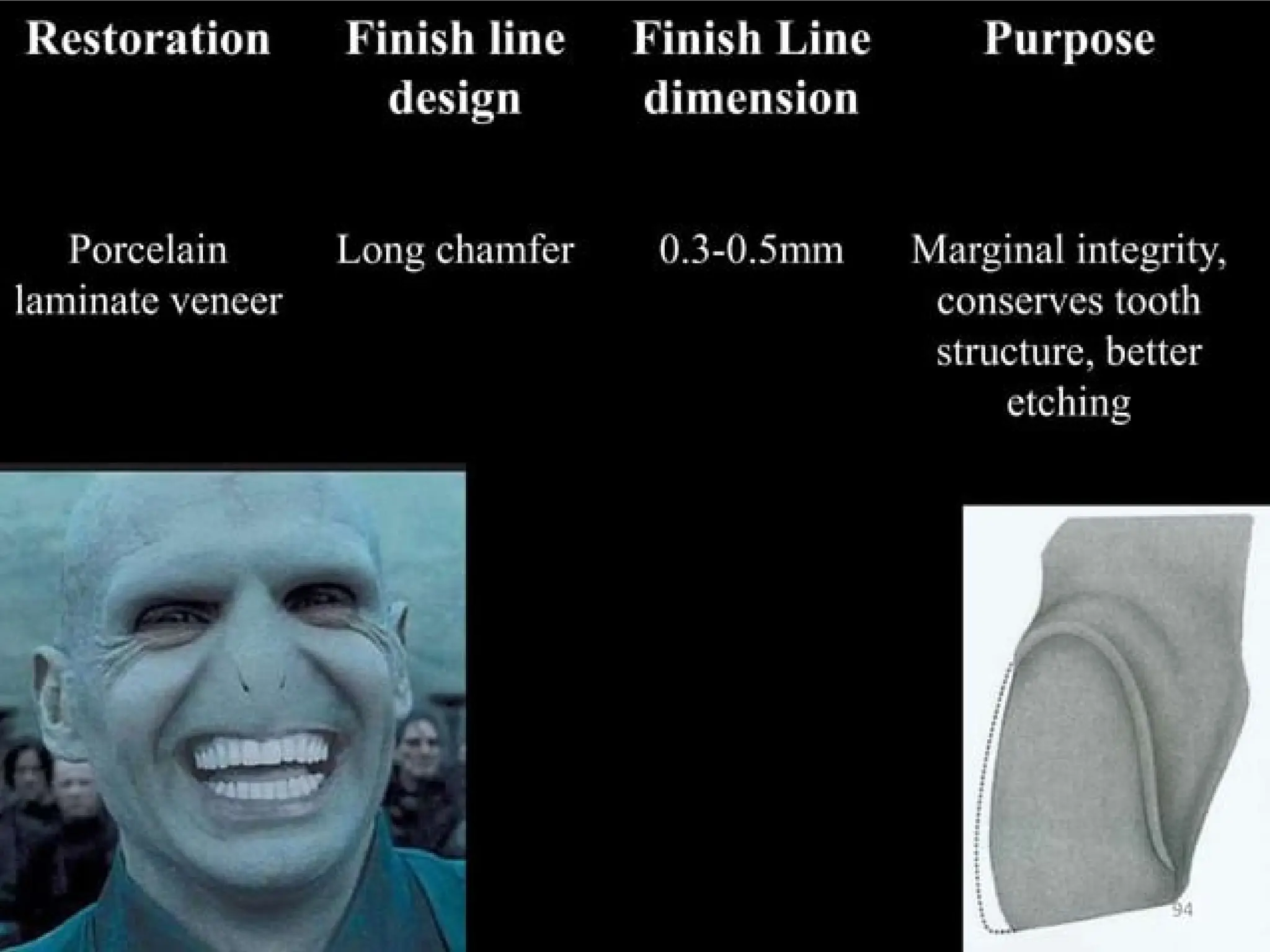 finish lines in fixed partial denture .pptx