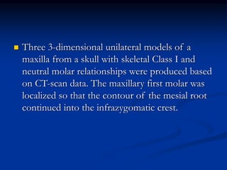  Three 3-dimensional unilateral models of a
maxilla from a skull with skeletal Class I and
neutral molar relationships were produced based
on CT-scan data. The maxillary first molar was
localized so that the contour of the mesial root
continued into the infrazygomatic crest.
 