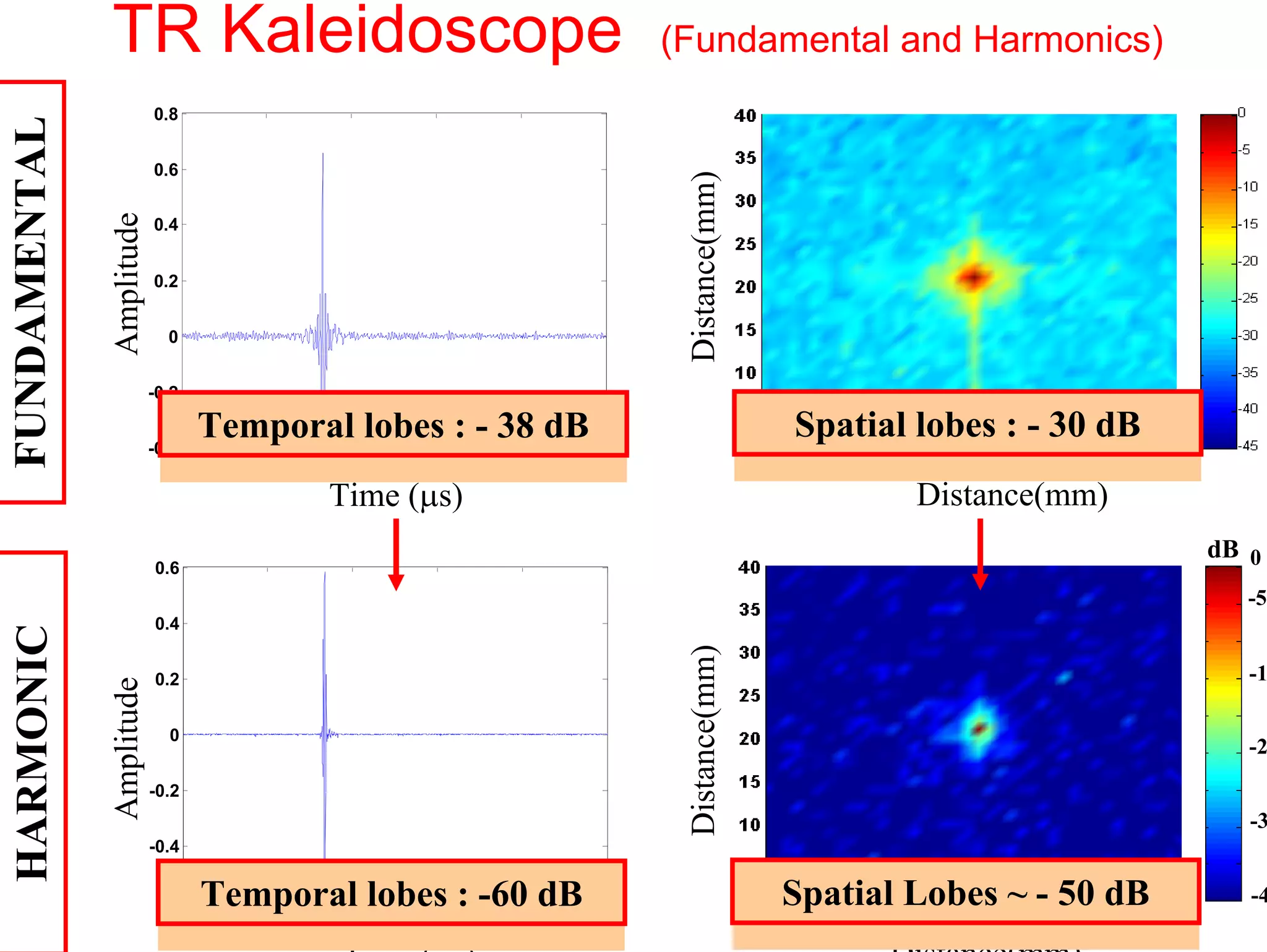 (Fundamental and Harmonics)
dB 0

0.8

-5

Distance(mm)

0.6

Amplitude

FUNDAMENTAL

TR Kaleidoscope
0.4
0.2
0

-15
-25
-35

-0.2
-0.4
0

Spatial lobes : - 30 dB

Temporal lobes : - 38 dB
20

40

60

80

100

Time (µs)

-45

Distance(mm)
dB 0

0.6

Distance(mm)

Amplitude

HARMONIC

-5
0.4
0.2
0
-0.2

-15
-25
-35

-0.4

0

Temporal lobes : -60 dB 100
20
40
60
80
Time (µs)

Spatial Lobes ~ - 50 dB
Distance(mm)

-45

 