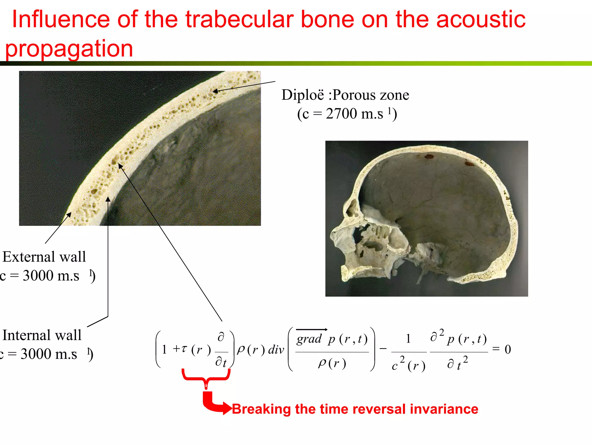 Influence of the trabecular bone on the acoustic
propagation
Diploë :Porous zone
(c = 2700 m.s 1)

External wall
(c = 3000 m.s 1)

Internal wall
(c = 3000 m.s 1)

2
 grad p ( r , t ) 
∂ 
1 ∂ p (r , t )

−
=0
 1 +τ ( r )  ρ ( r ) div 


2
2
∂t 
ρ (r )

∂t

 c (r )

Breaking the time reversal invariance

 