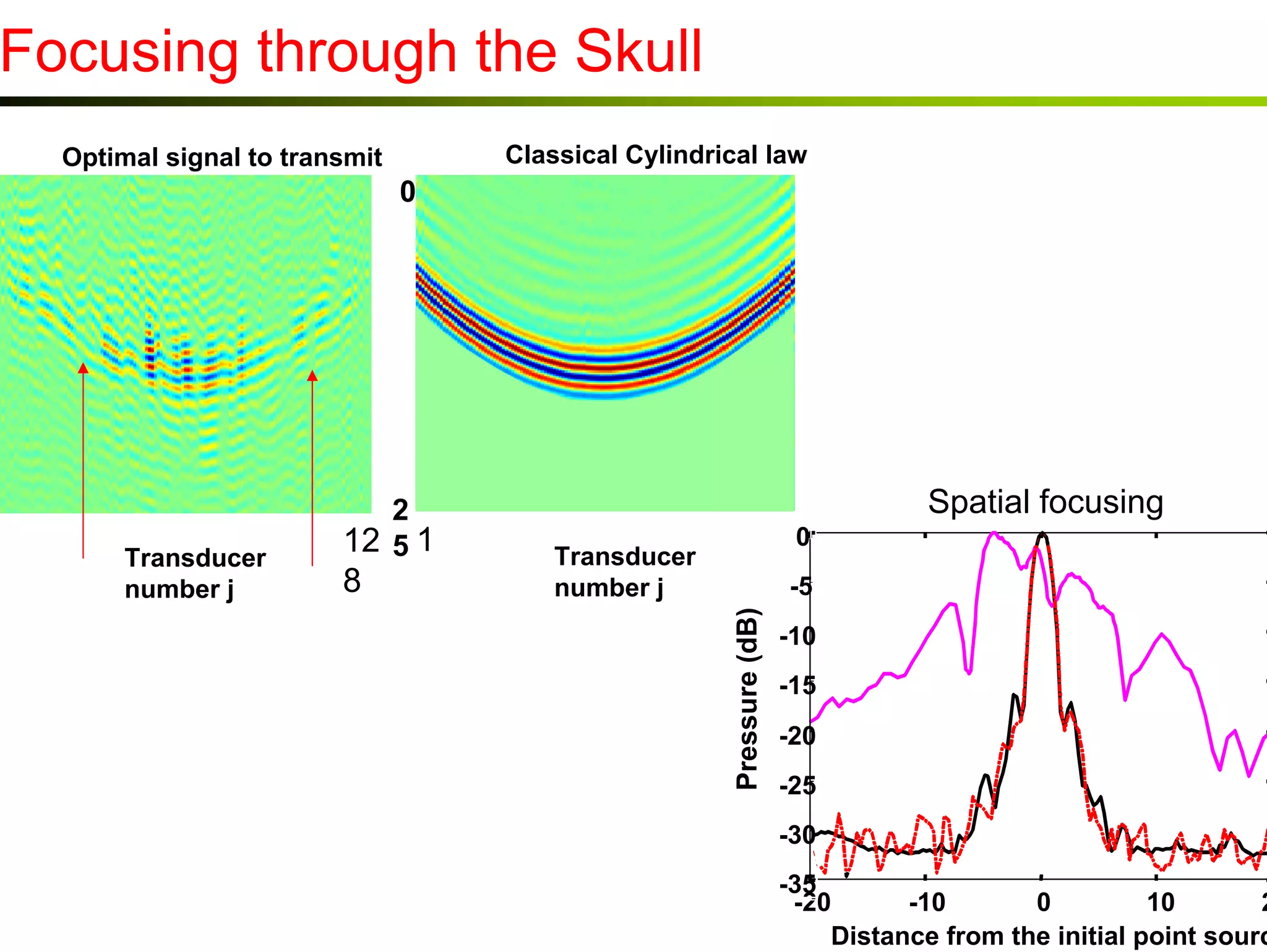Focusing through the Skull
Classical Cylindrical law

Optimal signal to transmit

2
51

0

Transducer
number j

2
12 5 1

8

Spatial focusing
0

Transducer
number j

-5

Pressure (dB)

0

-10
-15
-20
-25
-30
-35
-20
-10
0
10
20
Distance from the initial point source
(mm)

 
