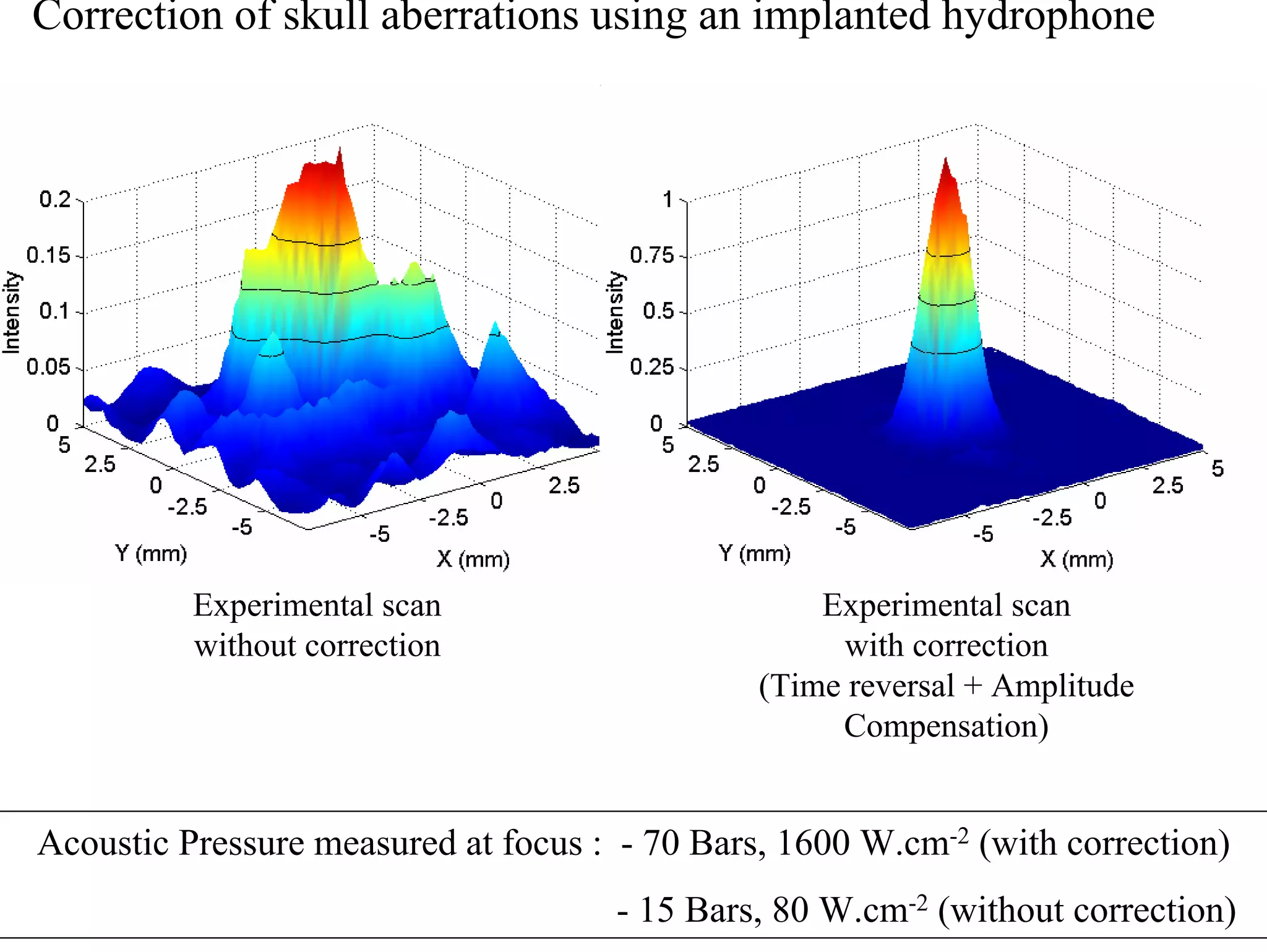 Correction of skull aberrations using an implanted hydrophone

Experimental scan
without correction

Experimental scan
with correction
(Time reversal + Amplitude
Compensation)

Acoustic Pressure measured at focus : - 70 Bars, 1600 W.cm-2 (with correction)
- 15 Bars, 80 W.cm-2 (without correction)

 
