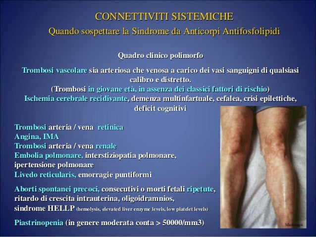 Guida ELEF - SINDROME DA ANTICORPI ANTIFOSFOLIPIDI