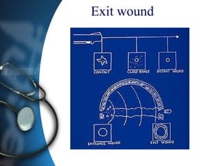 Exit wound
 