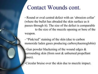 Contact Wounds cont. Round or oval central defect with an ‘abrasion collar’ (where the bullet has abraded the skin surface as it passes through it). The size of the defect is comparable  to the size of the muzzle opening or bore of the weapon. - “Pink/red” staining of the skin (due to carbon monoxide laden gases producing carboxyhaemoglobin) Gun powder blackening of the wound edges & surrounding skin (from soot & unburned propellant gases). Circular bruise over the skin due to muzzle impact. 