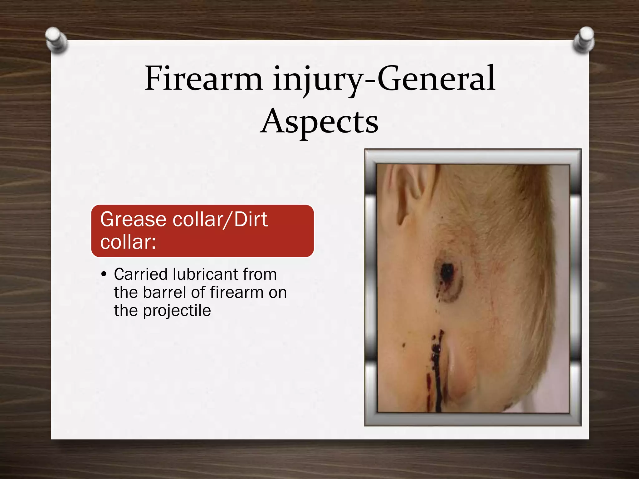 Firearm injury-General
Aspects
Grease collar/Dirt
collar:
• Carried lubricant from
the barrel of firearm on
the projectile

 