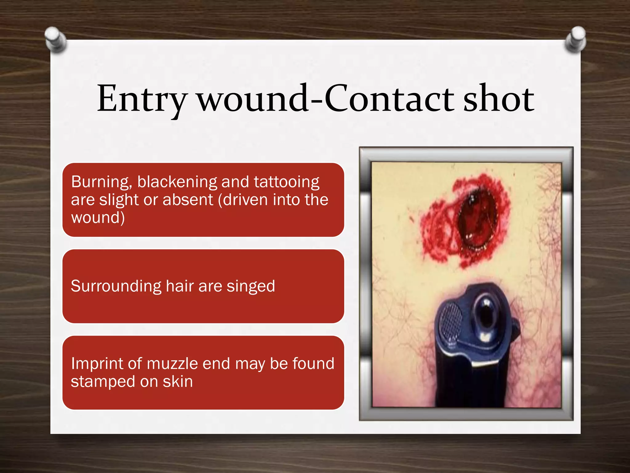 Entry wound-Contact shot
Burning, blackening and tattooing
are slight or absent (driven into the
wound)

Surrounding hair are singed

Imprint of muzzle end may be found
stamped on skin

 
