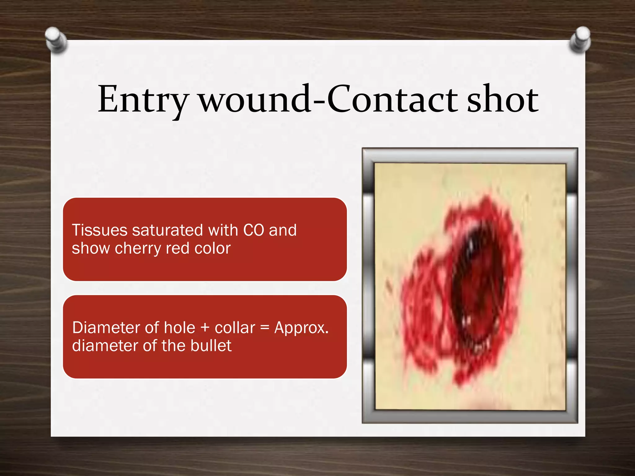Entry wound-Contact shot

Tissues saturated with CO and
show cherry red color

Diameter of hole + collar = Approx.
diameter of the bullet

 