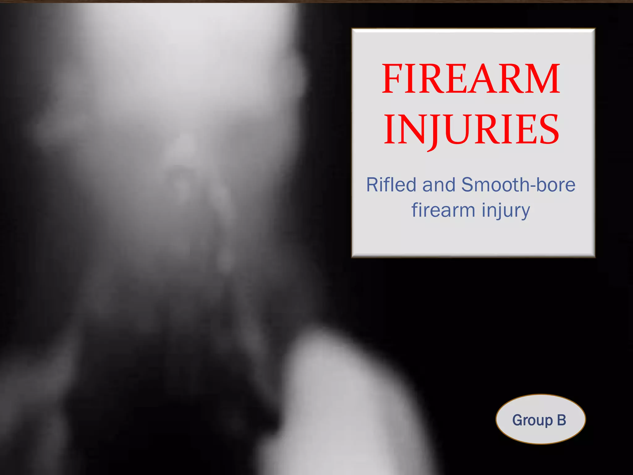 FIREARM
INJURIES
Rifled and Smooth-bore
firearm injury

Group B

 