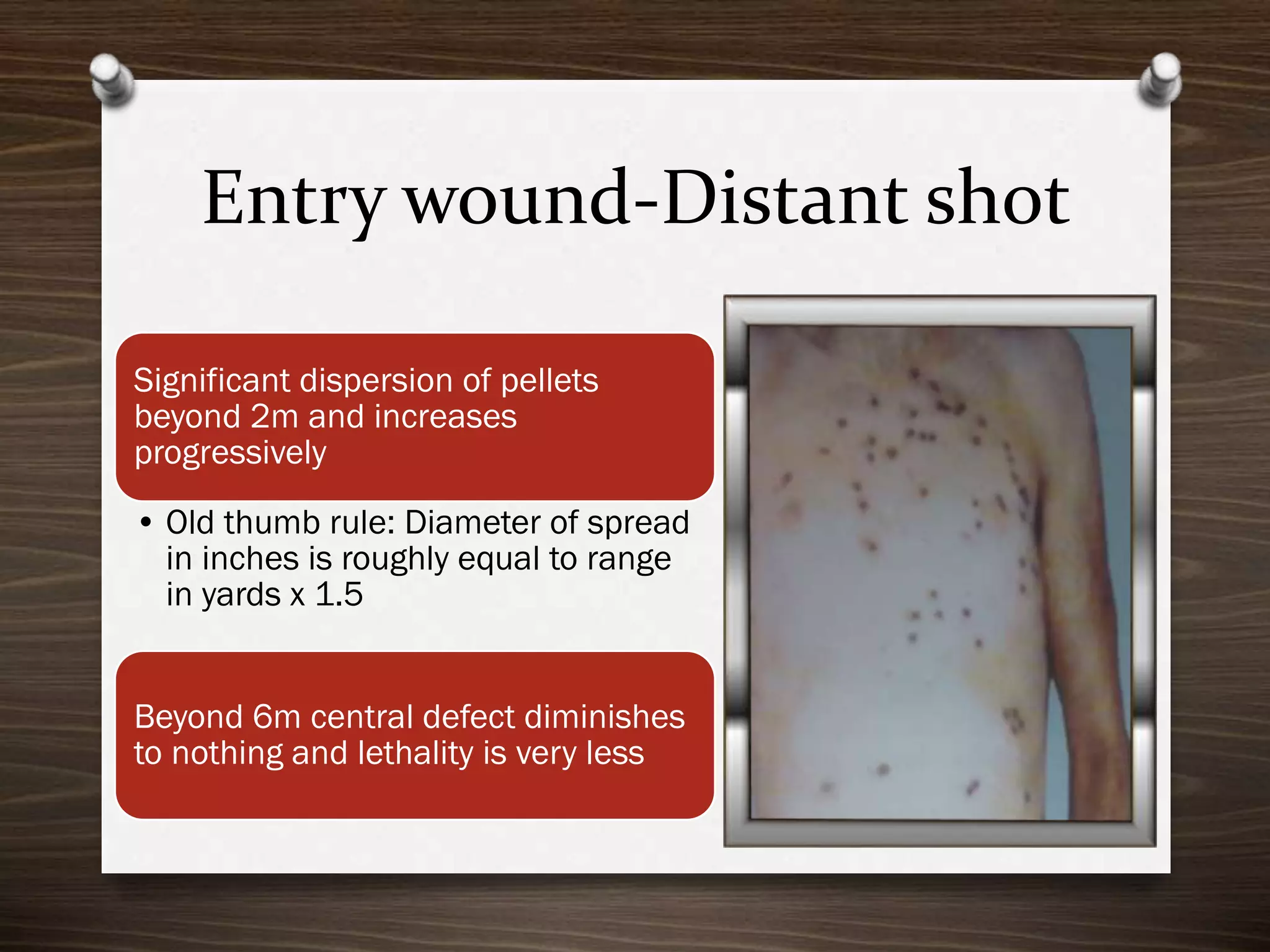 Entry wound-Distant shot
Significant dispersion of pellets
beyond 2m and increases
progressively
• Old thumb rule: Diameter of spread
in inches is roughly equal to range
in yards x 1.5
Beyond 6m central defect diminishes
to nothing and lethality is very less

 