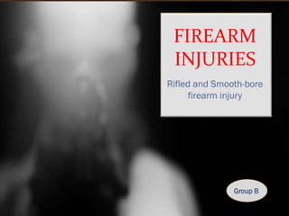 Firearm injuries_Forensics | PPTX