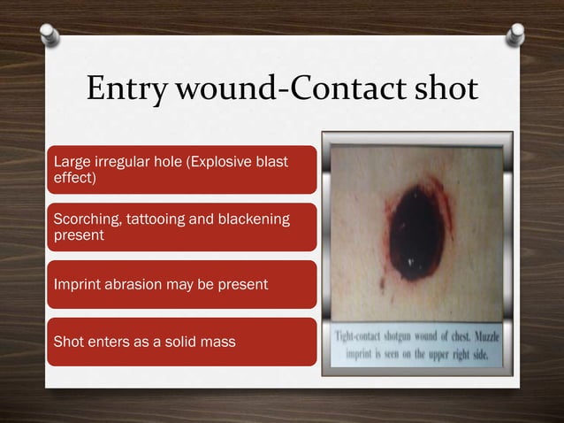 Firearm injuries_Forensics | PPTX | Arms & Ammunition | Sensitive Topics