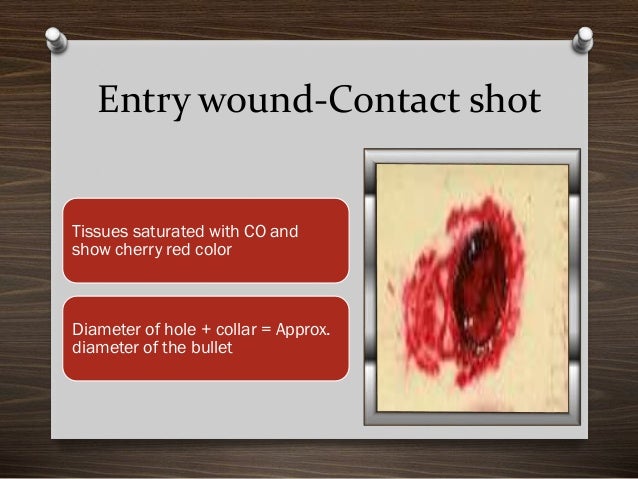 Firearm Injuries Forensics firearm-injuries-forensics