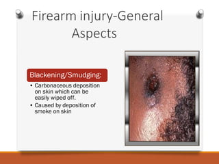 Firearminjuries | PDF