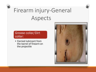 Firearminjuries | PDF