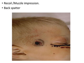 • Recoil /Muzzle impression.
• Back spatter
 