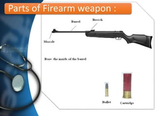 Parts of Firearm weapon :
 