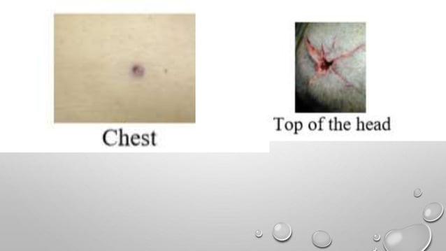 Firearm injuries | PPTX