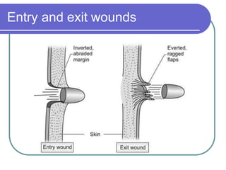 Entry and exit wounds
 