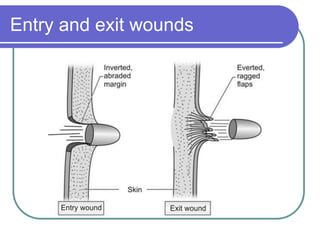 Entry and exit wounds
 