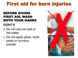 BEFORE GIVING
FIRST AID, WASH
BOTH YOUR HANDS
DONT’S
Do not use ice cold or
hot water
Do not apply ghee, tooth
paste or turmeric
powder
First aid for burn injuries
 