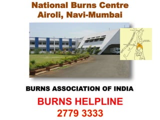 National Burns Centre
Airoli, Navi-Mumbai
BURNS ASSOCIATION OF INDIA
BURNS HELPLINE
 