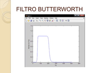 FILTRO BUTTERWORTH