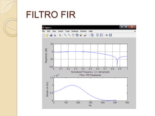 FILTRO FIR