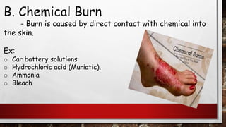 B. Chemical Burn
- Burn is caused by direct contact with chemical into
the skin.
Ex:
o Car battery solutions
o Hydrochloric acid (Muriatic).
o Ammonia
o Bleach
 