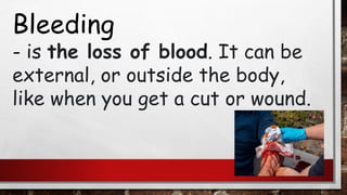Bleeding
- is the loss of blood. It can be
external, or outside the body,
like when you get a cut or wound.
 