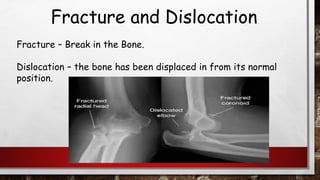 Fracture and Dislocation
Fracture – Break in the Bone.
Dislocation – the bone has been displaced in from its normal
position.
 