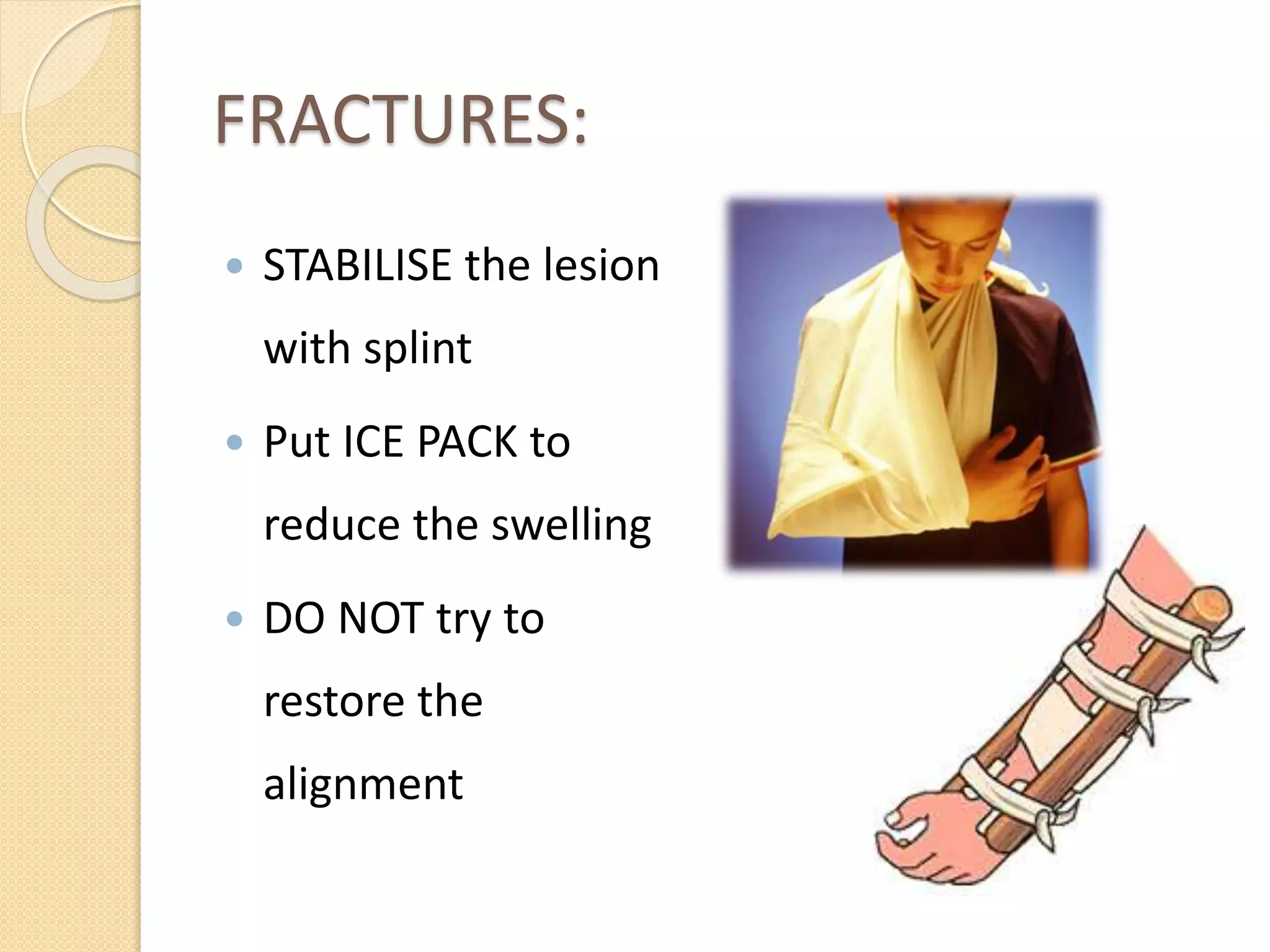 FRACTURES:
 STABILISE the lesion
with splint
 Put ICE PACK to
reduce the swelling
 DO NOT try to
restore the
alignment
 
