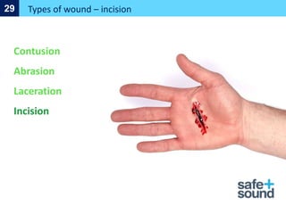 Types Of Cut Injuries First-Aid-Made-Easy-Training-Presentation.pptx