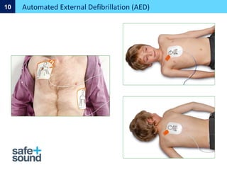 Automated External Defibrillation (AED)
10
 