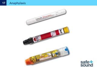 Anaphylaxis
17
 
