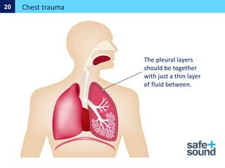 Chest trauma
20
The pleural layers
should be together
with just a thin layer
of fluid between.
 