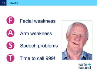 Facial weakness
Arm weakness
Speech problems
Time to call 999!
Stroke
13
F
A
S
T
 