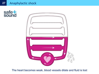 Anaphylactic shock
27
The heart becomes weak, blood vessels dilate and fluid is lost
 