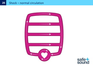 Shock – normal circulation
26
 