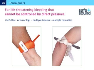 Tourniquets
30
For life-threatening bleeding that
cannot be controlled by direct pressure
Useful for: Arms or legs – multiple trauma – multiple casualties
 
