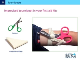 Tourniquets
30
Improvised tourniquet in your first aid kit:
Triangular bandage
Scissors
 