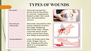 TYPES OF WOUNDS
 