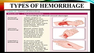 TYPES OF HEMORRHAGE
 