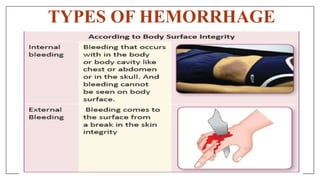 TYPES OF HEMORRHAGE
 
