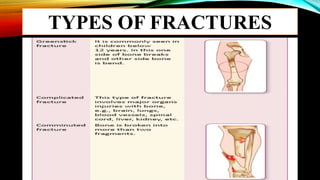TYPES OF FRACTURES
 