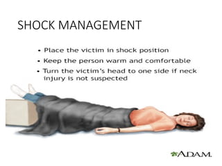 SHOCK MANAGEMENT
 