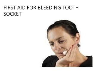 FIRST AID FOR BLEEDING TOOTH
SOCKET
 